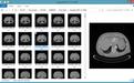 DICOM Thumbnailer(DICOM縮略圖查看器)v1.10.5綠色版